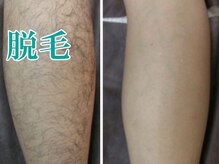 美宝 元町/膝下。