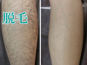 美宝 元町/膝下。