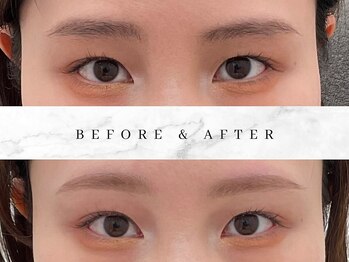 ナキ 富山店(Naki)/眉毛施術例 (眉毛Before.After)