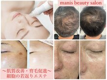 マニス(manis)
