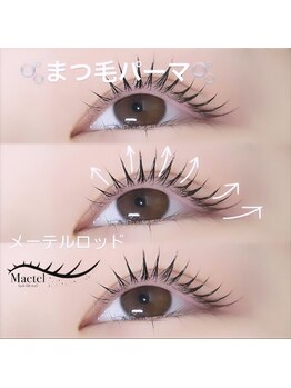 ドクターアリィ 岐南店(Dr.ALII)/人気のメーテルデザイン