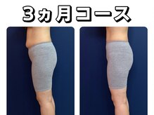 久留米スポーツ整骨院 整体院/エステ◆痩身インディバエステ