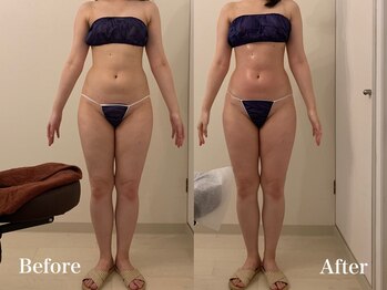 ラヴィエ ベル(La vie est belle)/セルライトゼロ2 全身