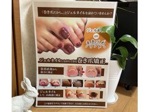 オース(Oath)の雰囲気（ずっと巻き爪に悩まれて来た方から感動の声が続出♪）