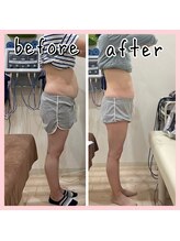 昭和区川名ひまわり接骨院/産後骨盤矯正×ダイエット【4】