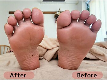 インナーライト(Inner-Light)/*Before&After*