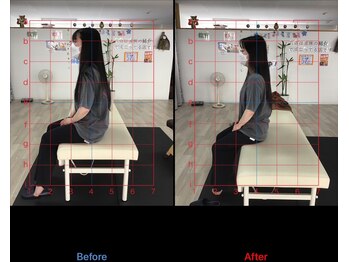 ストレチックス 近江八幡店/BeforeAfter
