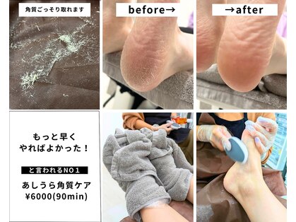 エクラ(ecla)の写真