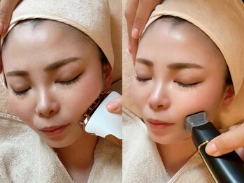 アトリエリュバン 心斎橋店(atelier Ruban)の写真/【ただの小顔施術じゃ満足できない方へ!】最新小顔術“脂肪分解導入×整顔EMS”で理想のフェイスラインに☆