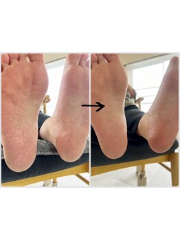 角質ケアができるサロン