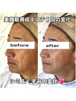 リエル(RIEL)/小顔矯正×美顔筋育成エステ