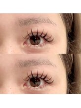 ナポーラ(NAPORA)/