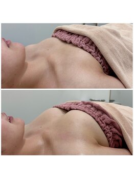 ビューティーサロン シンデレラ 心斎橋本店(Cinderella)/シンデレラバスト　20代後半