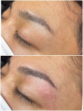 グロー(GLOW)/眉スタイリング＋眉周りWax脱毛