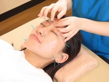 アカシア鍼灸整骨院