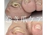 【Foot Care】巻き爪ケア１本施術