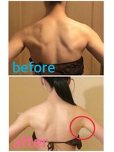 ヴィータローズディセ 名古屋本店(VITA ROSE Desse)/二の腕すっきり！