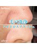 浮き出る毛穴黒ずみごっそり除去！角質ピーリング＋ハイドロ毛穴洗浄