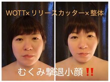 グロウ(GLOW)/小顔コースも豊富！