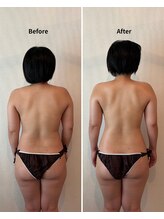 モティオ(motio)/ビフォーアフター