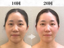 20回で"自分史上最高"のあなたへ導きます♪【四日市 エステ】