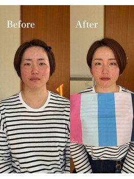 ルン(Lun.)/お客さまビフォーアフター