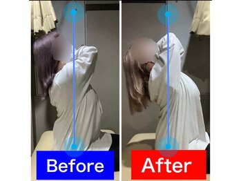 ナオル整体 仙台院(NAORU整体)/20代女性「猫背が気になる」