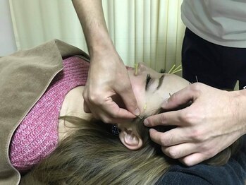 泉町鍼灸整骨院/美容専門による美容鍼施術を提供