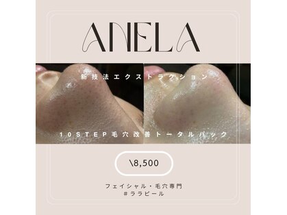 アネラ(ANELA)の写真