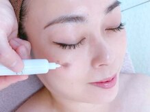 セゾン(Saison)の雰囲気（《シミペンシル》ペンシル型のシミケア機械でピンポイントにケア）
