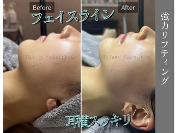 グロウ(glow.)/輪郭くっきり！コケさせない小顔