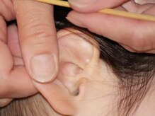 イヤーエステ専門店 耳ごらく 池袋《耳かき/ヘッドスパ/睡眠改善/肩こり》/