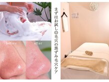 イニジアエリート 池袋店(inizia elite)/毛穴ケア