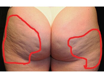 ヴィナーレ(VINARE)/美尻×腰肉集中60分