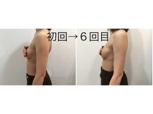 トータルビューティーサロン ナーズ(NAZ)/光バストアップ