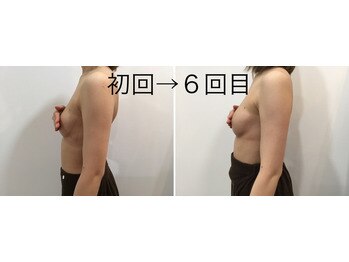 トータルビューティーサロン ナーズ(NAZ)/光バストアップ