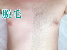 美宝 元町/パーツ別脱毛出来ます。