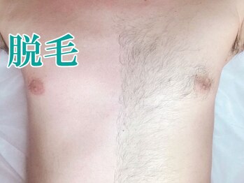 美宝 元町/パーツ別脱毛出来ます。