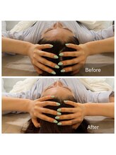 ステラルーテ(Stella lute)/頭の浮腫が取れました！