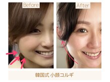 プリュボーテ(Pul Beaute)/韓国小顔コルギでスッキリ！