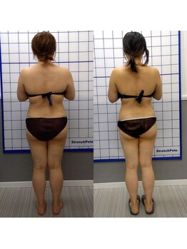 ラポール/ラポール痩身&ダイエット