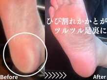 大人ネイルの雰囲気（【ひび割れかかと】がフットケアでモチツルの赤ちゃん肌に改善◎）