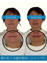 ハリラボ(hari Lab.)/【お客様の声】