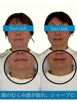 ハリラボ(hari Lab.)/【お客様の声】