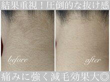 アリスビューティー(AliceBeauty)/圧倒的抜け感！満足度◎