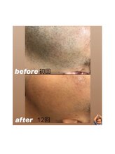 エリクサー 太田店(Elixir)/before after