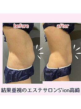 シオン 高崎(S'ion)/【お腹の引き締め痩身】