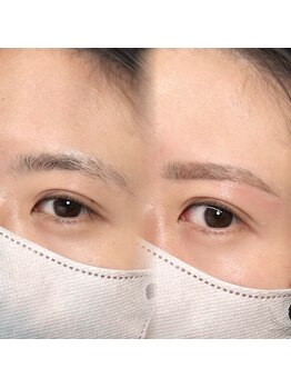 チル アンド アイ 船橋駅前店(Chill&Eye)/美眉スタイリング/BeforeAfter