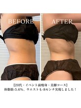 ヨサパーク スリー 西日暮里(YOSA PARK three)/Before After