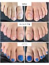 フットネイル